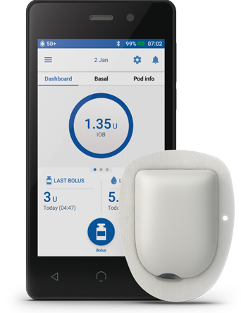 PDM and Pod with adhesive