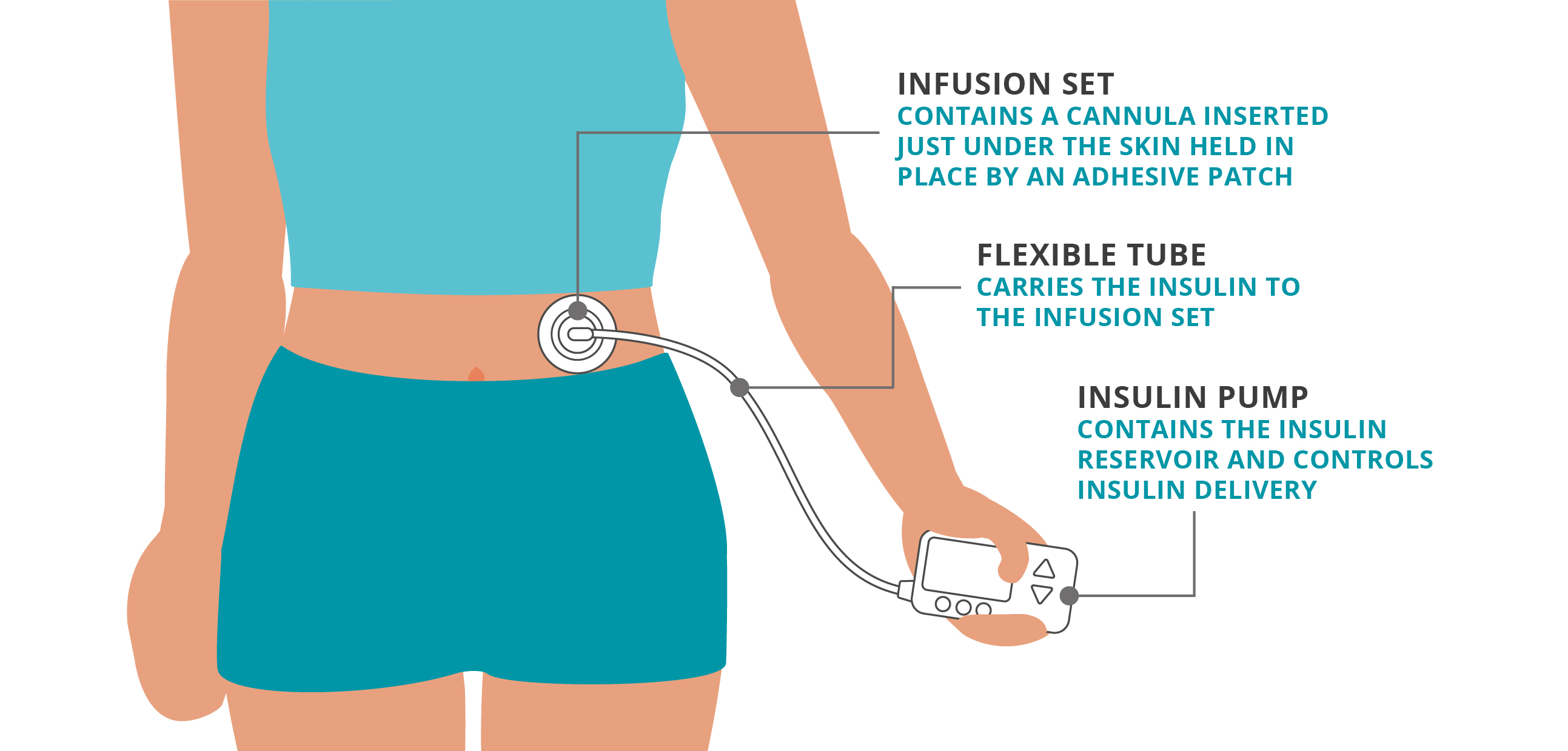 Insulin pump features
