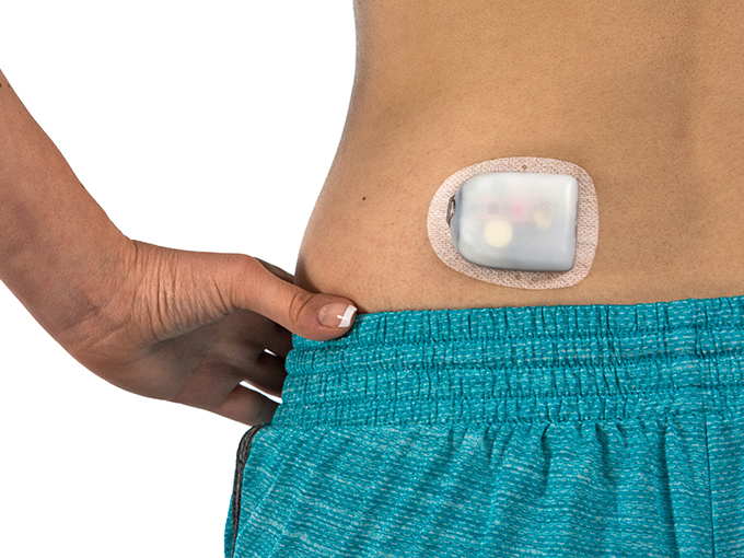 Omnipod  Insulin Pump Therapy, Simplified