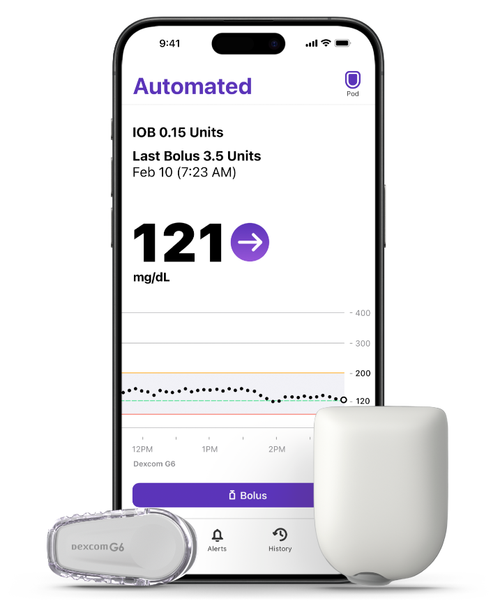 Omnipod 5 iOS iPhone Pod right and Dexcom G6 left no adhesive