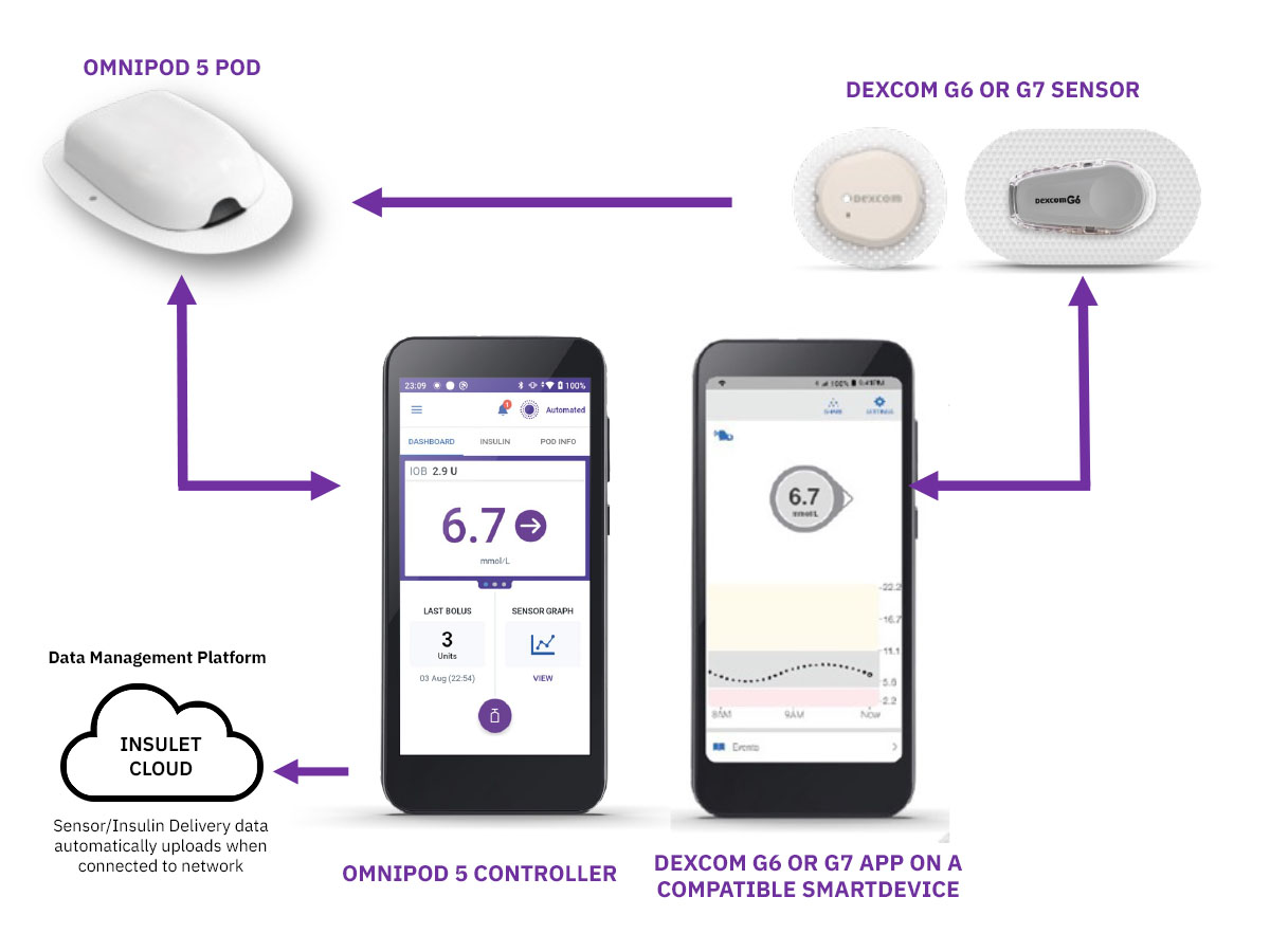 Dexcom How it works diagram