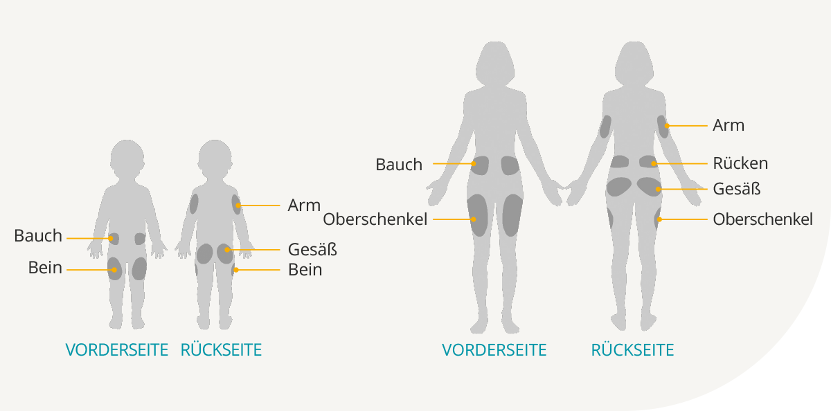 Pod Placement Diagram