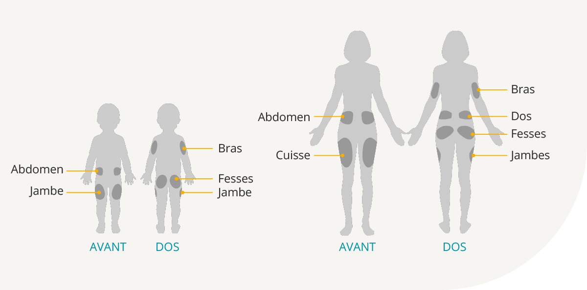 Pod Placement Diagram