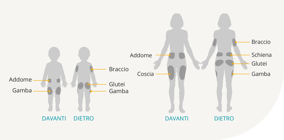 Pod Placement Diagram